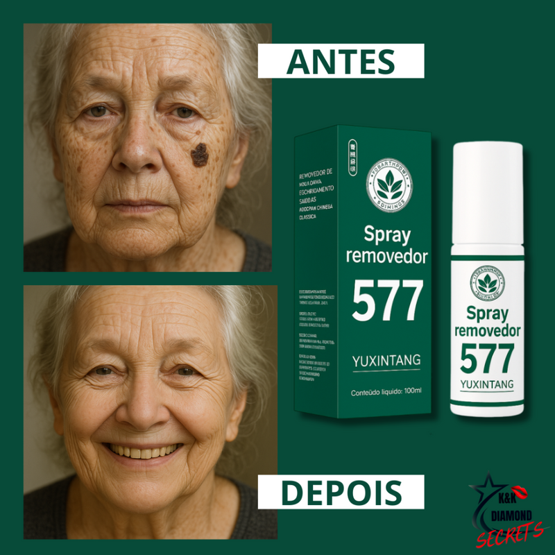 577-Spray Remove manchas de SOL, IDADE, GRAVIDA E MELASMA! 50% DE DESCONTO + FRETE GRÁTIS!