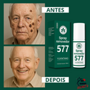 Clareador Spray Premium 577 – Elimine Manchas e Rejuvenesça Sua Pele _ Mais de 50% OFF + Frete Grátis !