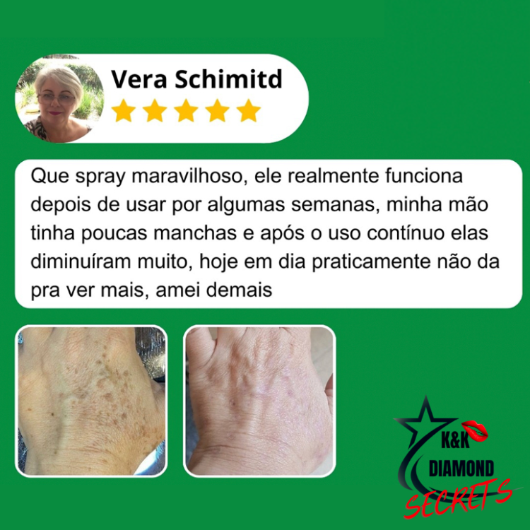 Clareador Spray Premium 577 – Elimine Manchas e Rejuvenesça Sua Pele _ Mais de 50% OFF + Frete Grátis !