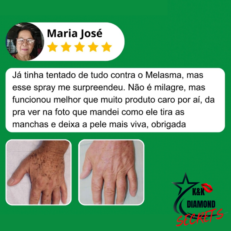 Clareador Spray Premium 577 – Elimine Manchas e Rejuvenesça Sua Pele _ Mais de 50% OFF + Frete Grátis !