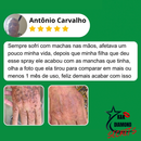 Clareador Spray Premium 577 – Elimine Manchas e Rejuvenesça Sua Pele _ Mais de 50% OFF + Frete Grátis !