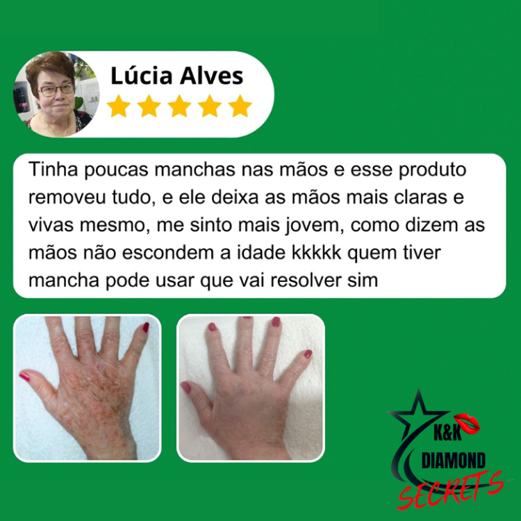 Clareador Spray Premium 577 – Elimine Manchas e Rejuvenesça Sua Pele _ Mais de 50% OFF + Frete Grátis !