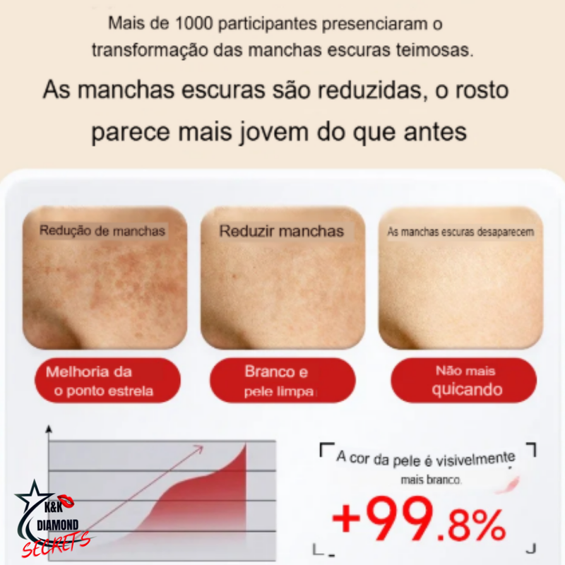577-Spray Remove manchas de SOL, IDADE, GRAVIDA E MELASMA! 50% DE DESCONTO + FRETE GRÁTIS!