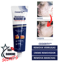 Removedor de Verrugas e manchas CEOERTY BLEMISG - 50% DE DESCONTO + FRETE GRÁTIS!