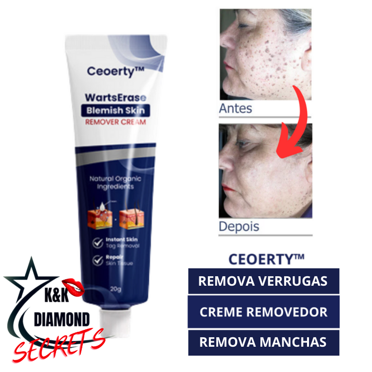 Removedor de Verrugas e manchas CEOERTY BLEMISG - 50% DE DESCONTO + FRETE GRÁTIS!