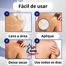 Removedor de Verrugas e manchas CEOERTY BLEMISG - 50% DE DESCONTO + FRETE GRÁTIS!