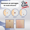 Removedor de Verrugas e manchas CEOERTY BLEMISG - 50% DE DESCONTO + FRETE GRÁTIS!