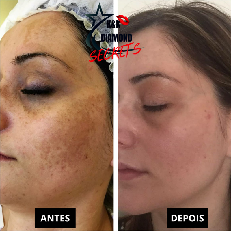 Limpeza de Pele Trans Resveratrol Premium Americano + Vitamina K2 - 50% DE DESCONTO + FRETE GRÁTIS