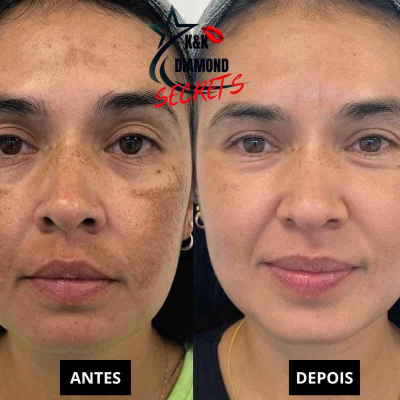 Limpeza de Pele Trans Resveratrol Premium Americano + Vitamina K2 - 50% DE DESCONTO + FRETE GRÁTIS