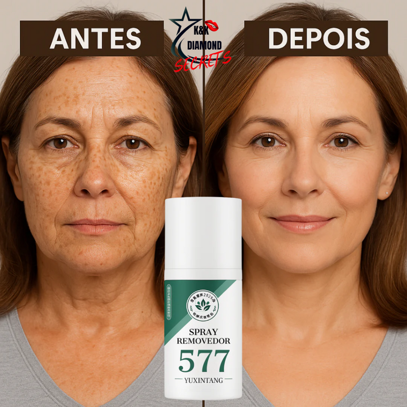 Clareador Spray Premium 577 – Elimine Manchas e Rejuvenesça Sua Pele _ Mais de 50% OFF + Frete Grátis !