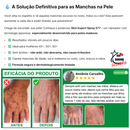 Clareador Spray Premium 577 – Elimine Manchas e Rejuvenesça Sua Pele _ Mais de 50% OFF + Frete Grátis !