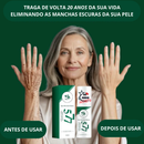 Clareador Spray Premium 577 – Elimine Manchas e Rejuvenesça Sua Pele _ Mais de 50% OFF + Frete Grátis !