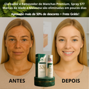 Clareador Spray Premium 577 – Elimine Manchas e Rejuvenesça Sua Pele _ Mais de 50% OFF + Frete Grátis !