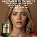 Clareador Spray Premium 577 – Elimine Manchas e Rejuvenesça Sua Pele _ Mais de 50% OFF + Frete Grátis !