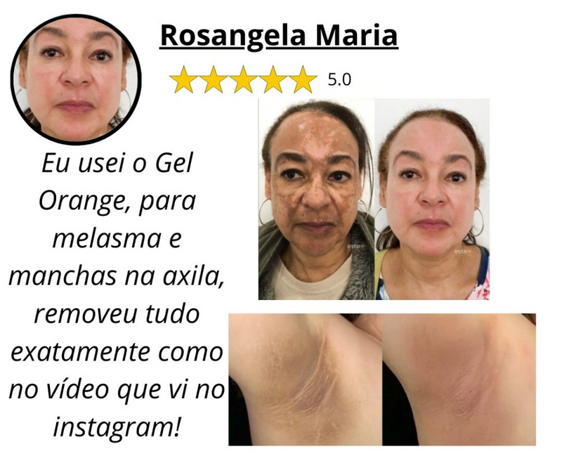 Esfoliante Gel Orange Acabe de Vez com Manchas Escuras _ Mais de 50% OFF + Frete Grátis !