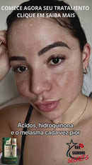 Clareador Spray Premium 577 – Elimine Manchas e Rejuvenesça Sua Pele _ Mais de 50% OFF + Frete Grátis !